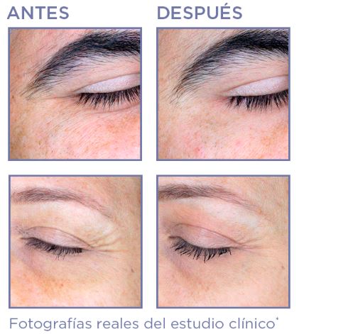 antes