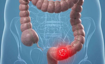 fotonoticia 20190331002936 420